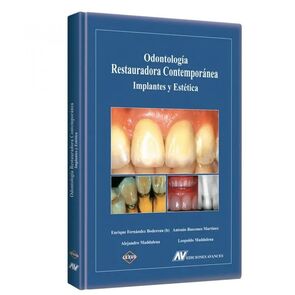 Odontología Restauradora Contemporánea Implantes y Estética